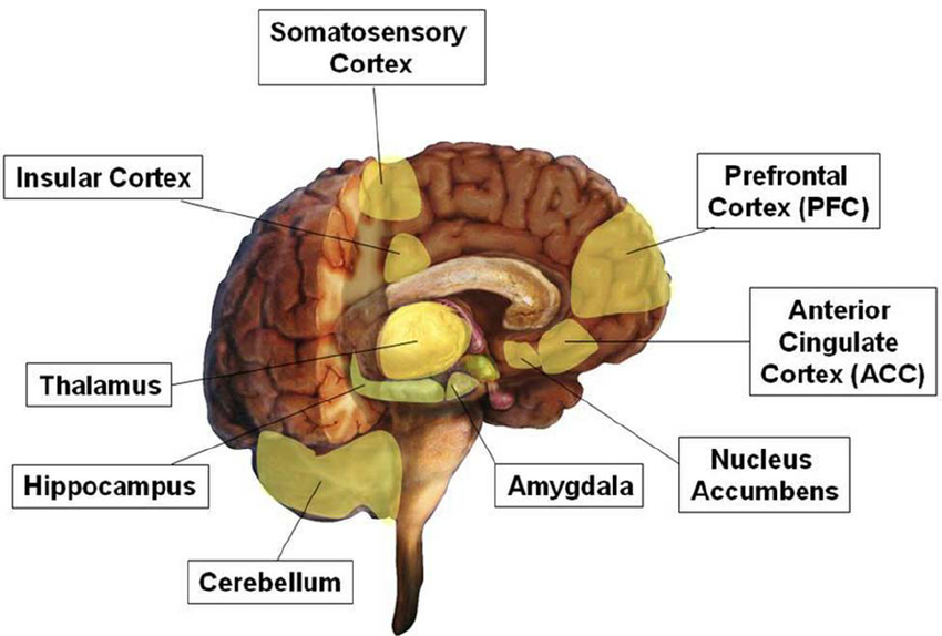Areas of the brain implicated in major depressive disorder MDD and pain disorders மானுட சமூகத்தின் பரிணாமம் (பாகம் 03)- ந.மாலதி