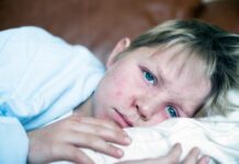 அமெரிக்காவில் 35 ஆண்டுகளில் இல்லாத அளவுக்கு தட்டம்மை (Measles) பரவல்